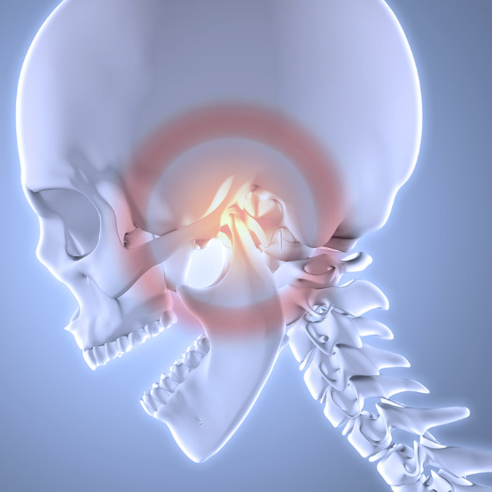 kiefergelenkbeschwerden